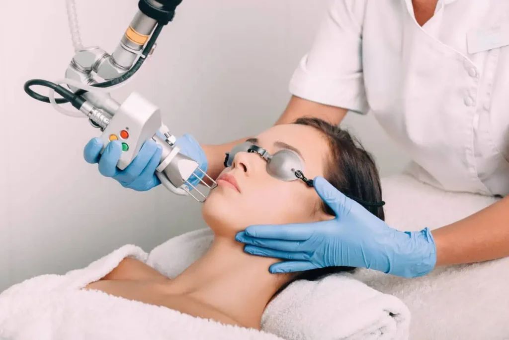 laser CO2 visage